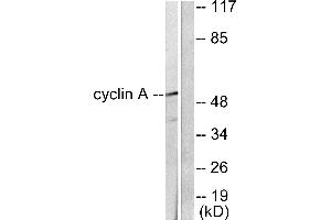 Western blot analysis of extracts from COS7 cells, using Cyclin A antibody (#C0165). (Cyclin A anticorps)