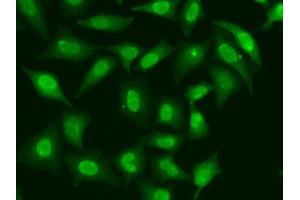 Immunofluorescence analysis of HeLa cells using TREX1 antibody (ABIN5974106). (TREX1 anticorps)