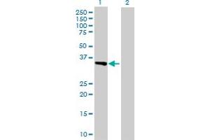 Western Blot analysis of ITGAV expression in transfected 293T cell line by ITGAV MaxPab polyclonal antibody. (CD51 anticorps  (AA 1-1048))