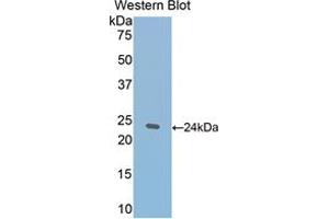 Western blot analysis of the recombinant protein. (Thrombospondin 1 anticorps  (AA 61-259))