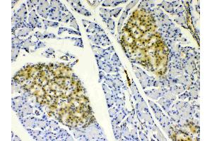 IHC analysis of HSPB8/Hsp22 using anti- HSPB8/Hsp22 antibody .