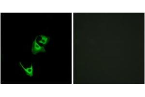 Immunofluorescence analysis of HeLa cells, using GLP1R Antibody. (GLP1R anticorps  (AA 101-150))