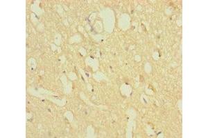 Immunohistochemistry of paraffin-embedded human brain tissue using ABIN7176279 at dilution of 1:100 (ZNF396 anticorps  (AA 1-200))