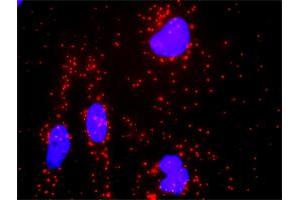 Proximity Ligation Analysis of protein-protein interactions between KLK3 and AR.
