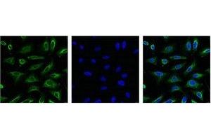IF analysis of Hela with antibody (Left) and DAPI (Right) diluted at 1:100.