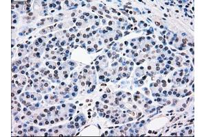 Image no. 2 for anti-B-Raf proto-oncogene, serine/threonine kinase (BRAF) antibody (ABIN1496954) (BRAF anticorps)