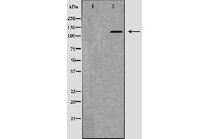 Western blot analysis of Hela whole cell lysates, using DDB1 Antibody.