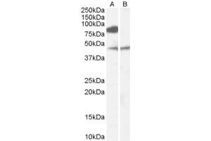 Western Blotting (WB) image for anti-Zinc Finger, DHHC-Type Containing 8 (ZDHHC8) (Internal Region) antibody (ABIN2466464) (ZDHHC8 anticorps  (Internal Region))