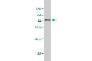 Western Blot detection against Immunogen (63. (RRAGB anticorps  (AA 1-346))