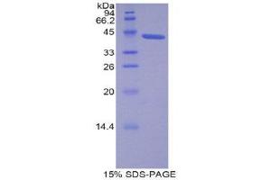 SDS-PAGE (SDS) image for Lipocalin 12 (LCN12) (AA 61-184) protein (His tag,GST tag) (ABIN1877953) (LCN12 Protein (AA 61-184) (His tag,GST tag))