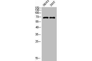 Western blot analysis of MOUSE-BRAIN lysate, antibody was diluted at 1000. (GADD34 anticorps  (AA 430-490))