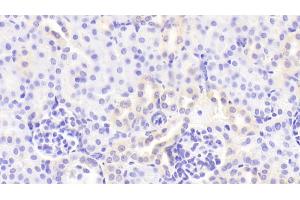 Detection of GM-CSF in Mouse Kidney Tissue using Polyclonal Antibody to Colony Stimulating Factor 2, Granulocyte Macrophage (GM-CSF)