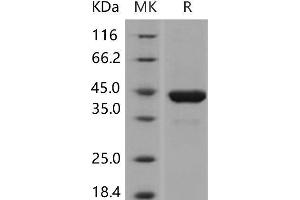 Western Blotting (WB) image for Phosphoglycerate Kinase 1 (PGK1) protein (His tag) (ABIN7197343)