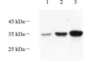 Western blot analysis of Torsin A (ABIN7075942) at dilution of 1: 1000,Lane 1: Mouse kidney tissue lysate,Lane 2: Mouse liver tissue lysate,Lane 3: Rat liver tissue lysate
