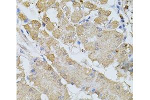 Immunohistochemistry of paraffin-embedded Human stomach using BEST1 Polyclonal Antibody at dilution of 1:100 (40x lens). (Bestrophin 1 anticorps)