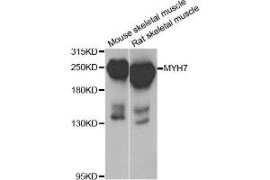 Western blot analysis of extracts of mouse skeletal muscle and rat skeletal muscle cell lines, using MYH7 antibody. (MYH7 anticorps)