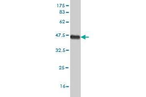 Western Blot detection against Immunogen (38. (FGFR1 anticorps  (AA 31-150))