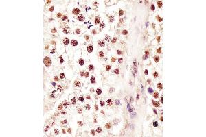 (ABIN6244063 and ABIN6578228) staining RBMX in human testis tissue sections by Immunohistochemistry (IHC-P - paraformaldehyde-fixed, paraffin-embedded sections). (RBMX anticorps  (AA 262-294))