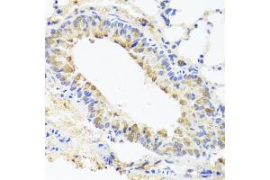 Immunohistochemistry of paraffin-embedded mouse lung using BGLAP antibody (ABIN5975009) at dilution of 1/100 (40x lens). (Osteocalcin anticorps)