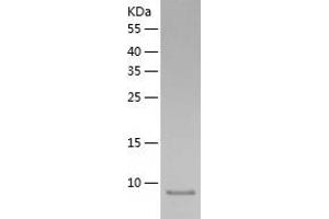 Western Blotting (WB) image for Resistin Like beta (RETNLB) (AA 24-105) protein (His-IF2DI Tag) (ABIN7124830)