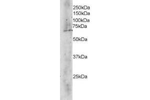ABIN184688 staining (4 ug/ml) of Human Brain lysate (RIPA buffer, 35 ug total protein per lane). (TBL1X anticorps  (C-Term))