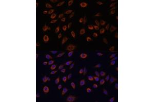 anti-Nucleoside-Triphosphatase, Cancer-Related (NTPCR) (AA 91-190) antibody