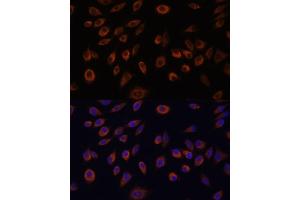 Immunofluorescence analysis of L929 cells using NTPCR antibody (ABIN7269059) at dilution of 1:100. (C1orf57 anticorps  (AA 91-190))