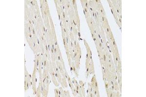 Immunohistochemistry of paraffin-embedded mouse heart using AAAS Antibody. (Adracalin anticorps  (AA 287-546))