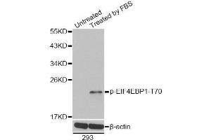 Western blot analysis of extracts of 293 cells, using Phospho-EIF4EBP1-T70 antibody. (eIF4EBP1 anticorps  (pThr70))