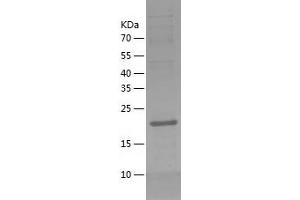 Western Blotting (WB) image for Thiamine Triphosphatase (THTPA) (AA 1-230) protein (His tag) (ABIN7125353)