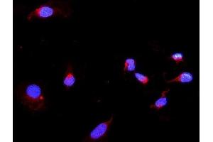 IF analysis of DARS2 using anti-DARS2 antibody (ABIN6719279). (DARS2 anticorps  (AA 334-448))