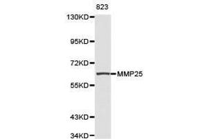 Western Blotting (WB) image for anti-Matrix Metallopeptidase 25 (MMP25) antibody (ABIN1873725) (MMP25 anticorps)