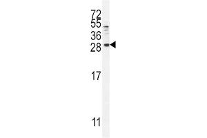 Western Blotting (WB) image for anti-Betacellulin (BTC) antibody (ABIN2996306) (Betacellulin anticorps)