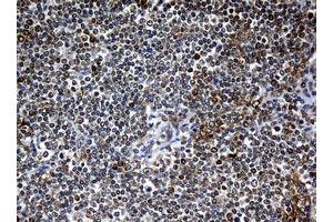 Image no. 5 for anti-Nibrin (NBN) (AA 461-754) antibody (ABIN1491539)