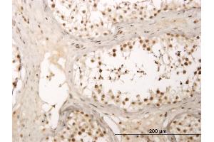 Immunoperoxidase of monoclonal antibody to ZNF213 on formalin-fixed paraffin-embedded human testis.