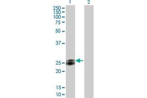 Western Blot analysis of EPDR1 expression in transfected 293T cell line by EPDR1 MaxPab polyclonal antibody.