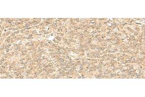 Immunohistochemistry of paraffin-embedded Human tonsil tissue using ENSA Polyclonal Antibody at dilution of 1:40(x200) (Ensa anticorps)