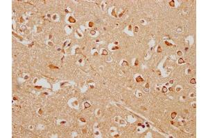 IHC image of ABIN7154933 diluted at 1:200 and staining in paraffin-embedded human brain tissue performed on a Leica BondTM system.