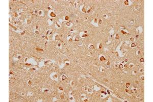 IHC image of ABIN7154933 diluted at 1:200 and staining in paraffin-embedded human brain tissue performed on a Leica BondTM system. (HHIP anticorps  (AA 183-424))
