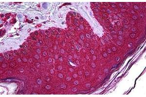 Human Skin: Formalin-Fixed, Paraffin-Embedded (FFPE)