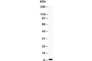 Western blot testing of Defensin 1 antibody at and COLO320 lysate;  Predicted size: 7KD;  Observed size: 7KD (beta Defensin 1 anticorps  (C-Term))