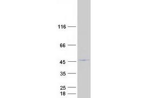 Validation with Western Blot