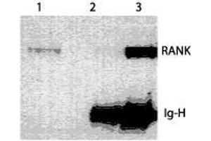 Image no. 1 for anti-Tumor Necrosis Factor Receptor Superfamily, Member 11a, NFKB Activator (TNFRSF11A) (Extracellular Domain) antibody (ABIN208201) (TNFRSF11A anticorps  (Extracellular Domain))