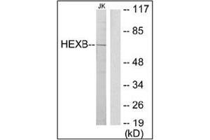 Western blot analysis of extracts from Jurkat cells using HEXB Antibody . (HEXB anticorps  (C-Term))