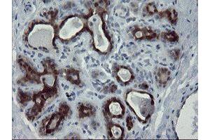 Image no. 3 for anti-Peptidyl Arginine Deiminase, Type IV (PADI4) (AA 299-588) antibody (ABIN1491357)