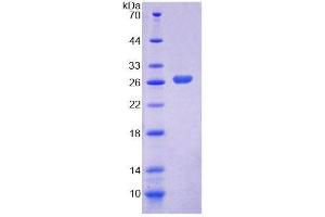 SDS-PAGE analysis of Human LRP1B Protein. (LRP1B Protéine)
