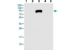 Western blot analysis of Lane 1: RT-4, Lane 2: U-251 MG, Lane 3: Human Plasma, Lane 4: Liver, Lane 5: Tonsil with IGFALS polyclonal antibody  at 1:250-1:500 dilution. (IGFALS anticorps)
