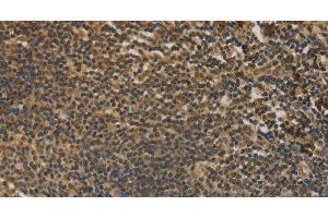 Immunohistochemistry of paraffin-embedded Human tonsil tissue using DACH1 Polyclonal Antibody at dilution 1:50