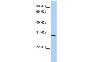 ZFYVE28 antibody used at 0.