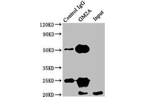 Immunoprecipitating GM2A in HEK293 whole cell lysate Lane 1: Rabbit control IgG instead of ABIN7153574 in HEK293 whole cell lysate.